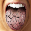 Why Oral Probiotics Help Dry Mouth